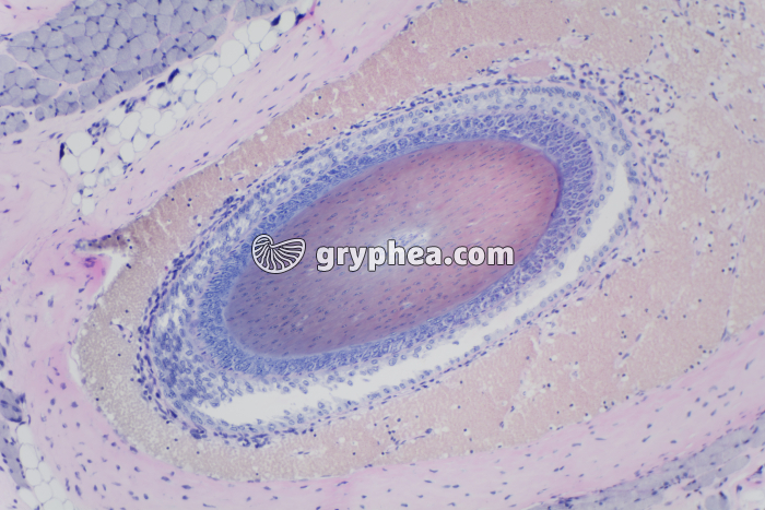 Peau avec glandes sébacées x40 - gryphea.org